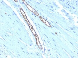 ABO, Blood Group A Antigen Antibody (HE-193), Novus Biologicals 0.2mg;